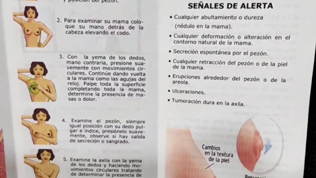 «La prevención del cáncer de mama es esencial»